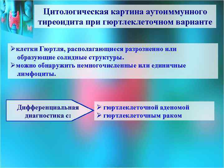 Цитологическая картина аутоиммунного тиреоидита при гюртлеклеточном варианте Øклетки Гюртля, располагающиеся разрозненно или образующие солидные