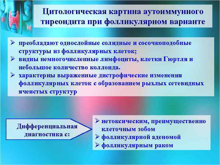 Цитологическая картина аутоиммунного тиреоидита при фолликулярном варианте Ø преобладают однослойные солидные и сосочкоподобные структуры