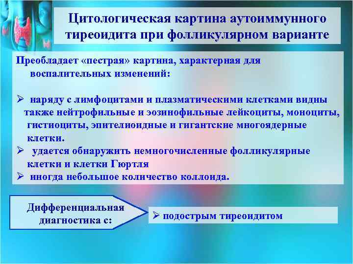 Цитологическая картина аутоиммунного тиреоидита при фолликулярном варианте Преобладает «пестрая» картина, характерная для воспалительных изменений: