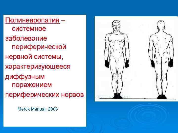 Полиневропатия – системное заболевание периферической нервной системы, характеризующееся диффузным поражением периферических нервов The Merck
