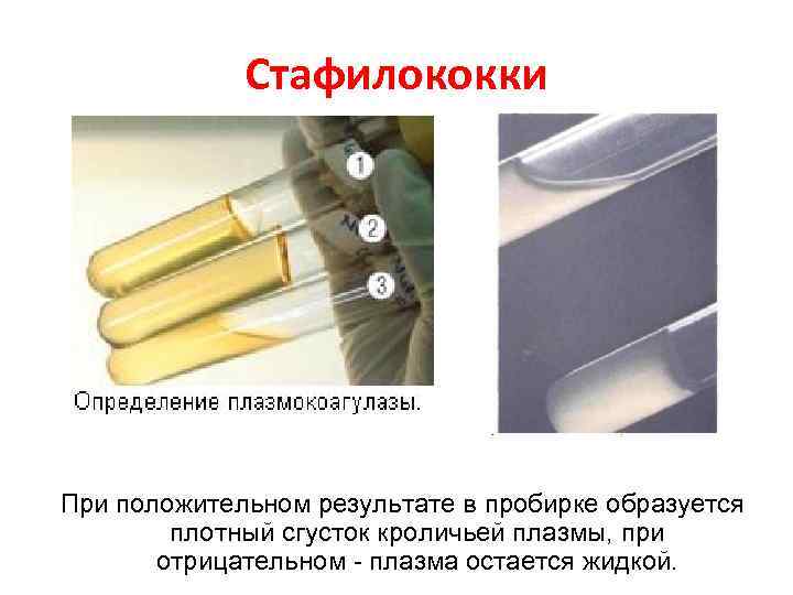 Стафилококки При положительном результате в пробирке образуется плотный сгусток кроличьей плазмы, при отрицательном -