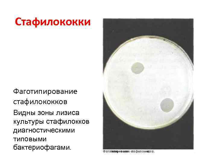 Стафилококки Фаготипирование стафилококков Видны зоны лизиса культуры стафилокков диагностическими типовыми бактериофагами. 