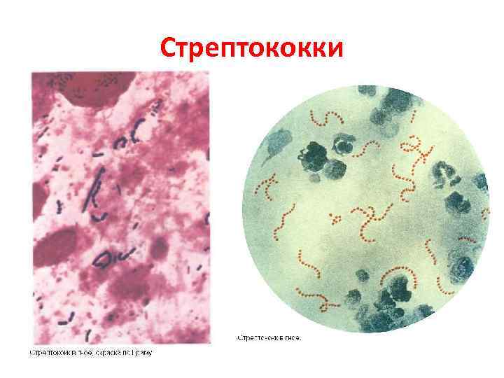 Стрептококки 