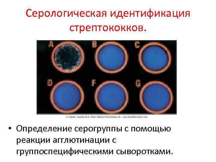 Серологическая идентификация стрептококков. • Определение серогруппы с помощью реакции агглютинации с группоспецифическими сыворотками. 