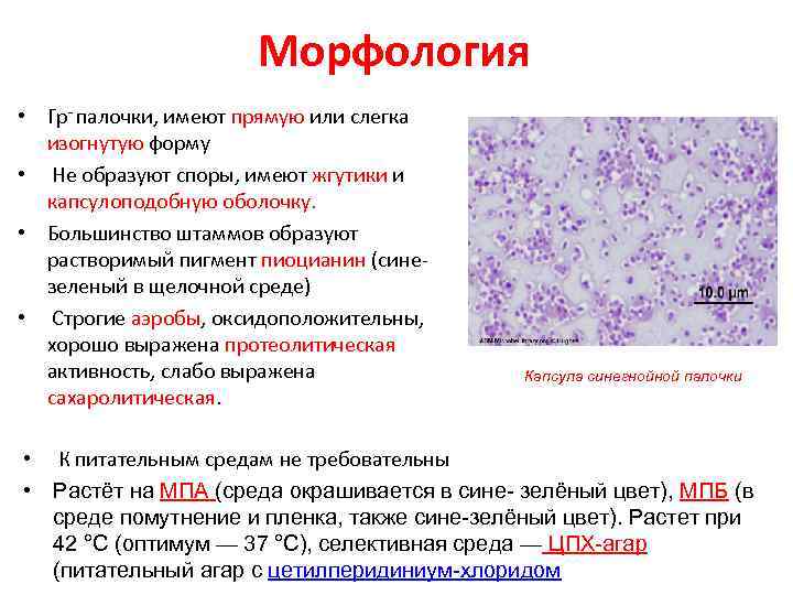 Морфология • Гр- палочки, имеют прямую или слегка изогнутую форму • Не образуют споры,