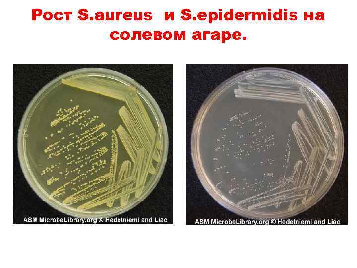 Рост S. aureus и S. epidermidis на солевом агаре. 