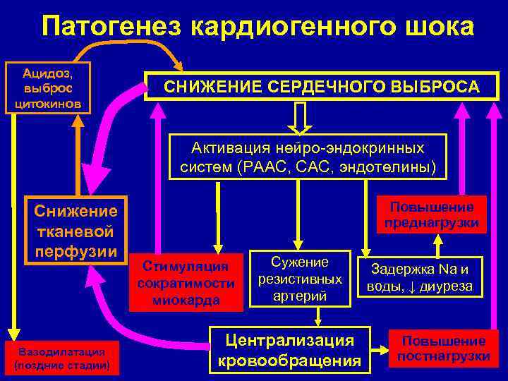 Кардиогенный шок при остром инфаркте миокарда