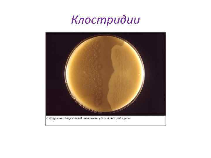 Клостридии 