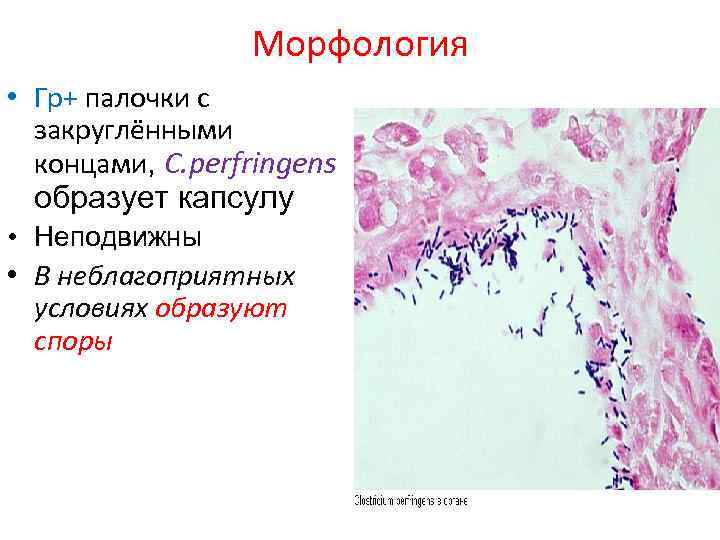 Морфология • Гр+ палочки с закруглёнными концами, C. perfringens образует капсулу • Неподвижны •