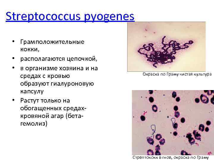 Streptococcus pyogenes • Грамположительные кокки, • располагаются цепочкой, • в организме хозяина и на