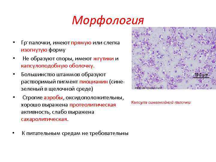 Морфология • Гр- палочки, имеют прямую или слегка изогнутую форму • Не образуют споры,