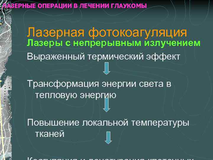 ЛАЗЕРНЫЕ ОПЕРАЦИИ В ЛЕЧЕНИИ ГЛАУКОМЫ Лазерная фотокоагуляция Лазеры с непрерывным излучением Выраженный термический эффект