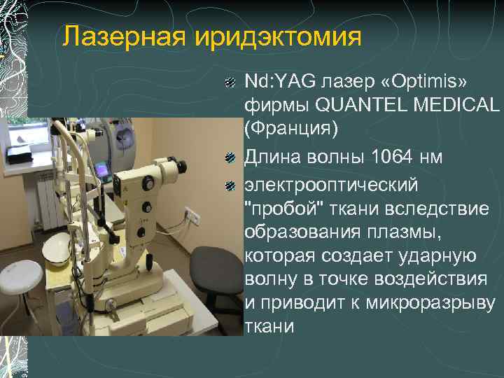 Лазерная иридэктомия. Yag лазер Optimis. Лазерная базальная иридэктомия восстановительный период. Yag лазере Optimis II Quantel Medical sa Франция..