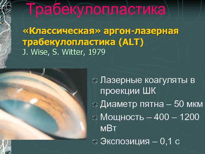 Трабекулопластика «Классическая» аргон-лазерная трабекулопластика (ALT) J. Wise, S. Witter, 1979 Лазерные коагуляты в проекции