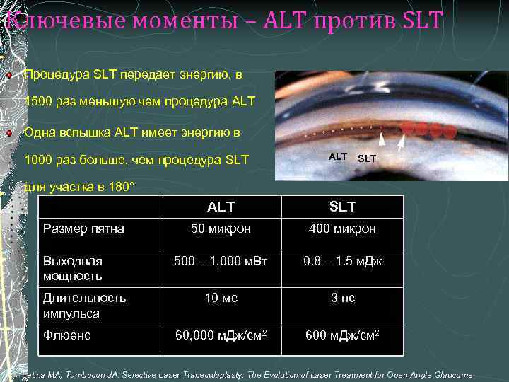Ключевые моменты – ALT против SLT Процедура SLT передает энергию, в 1500 раз меньшую
