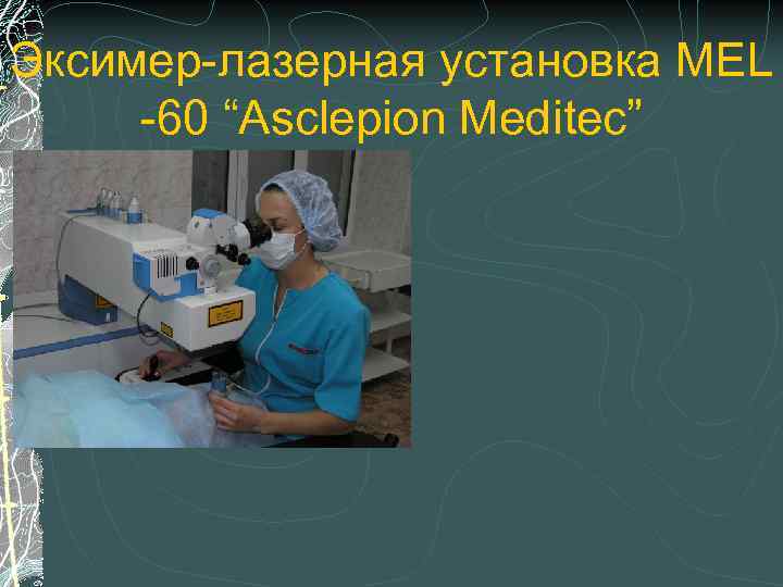 Эксимер-лазерная установка MEL -60 “Asclepion Meditec” 