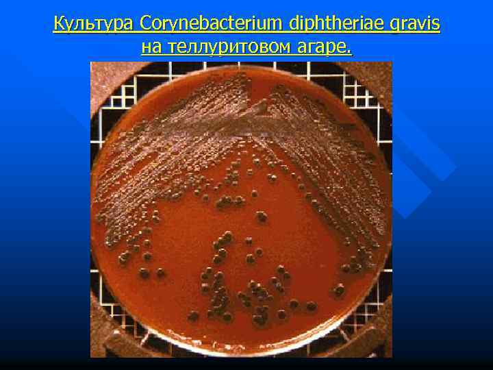 Культура Corynebacterium diphtheriae gravis на теллуритовом агаре. 