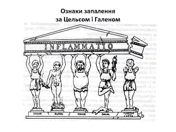 Ознаки запалення за Цельсом і Галеном 