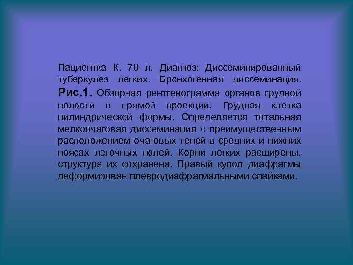 Пациентка К. 70 л. Диагноз: Диссеминированный туберкулез легких. Бронхогенная диссеминация. Рис. 1. Обзорная рентгенограмма