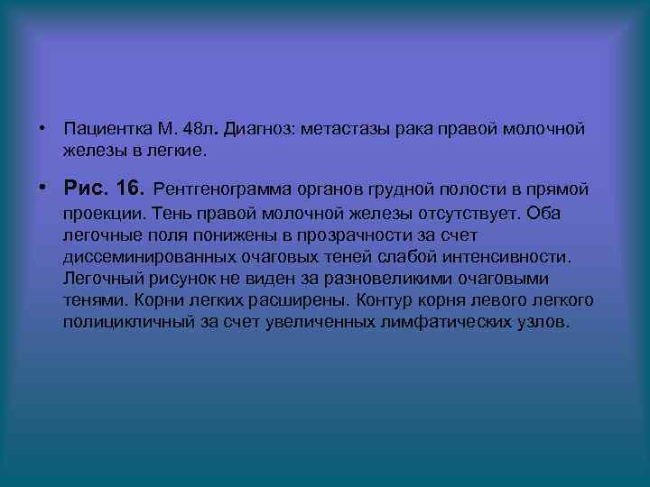  • Пациентка М. 48 л. Диагноз: метастазы рака правой молочной железы в легкие.