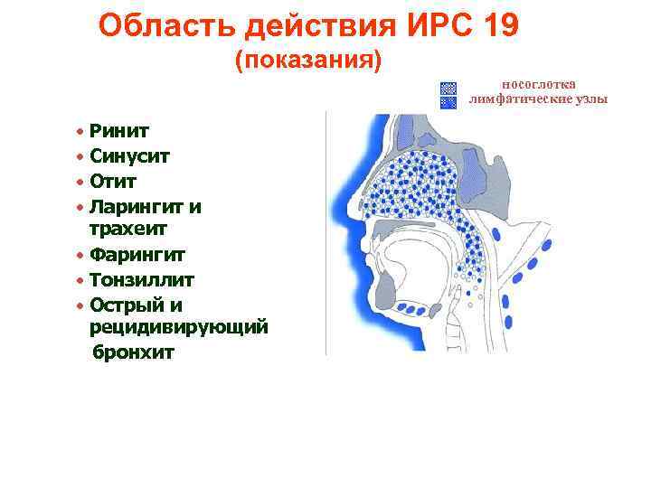 Область действия ИРС 19 (показания) носоглотка лимфатические узлы • Ринит • Синусит • Отит