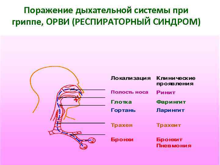 Поражение дыхательной системы при гриппе, ОРВИ (РЕСПИРАТОРНЫЙ СИНДРОМ) 