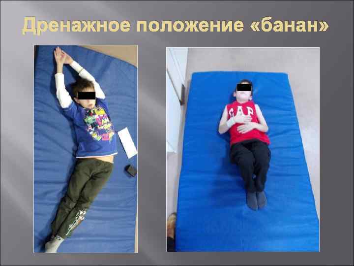 Дренажное положение «банан» 