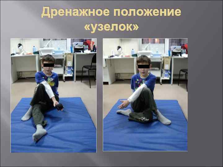 Дренажное положение «узелок» 