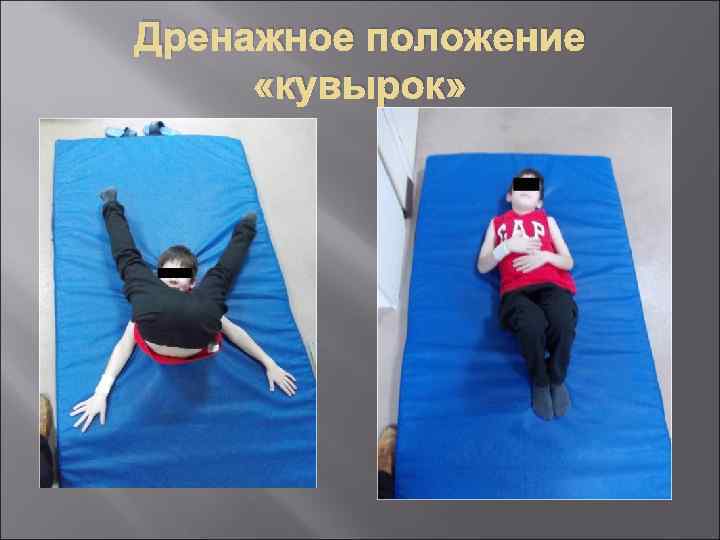 Дренажное положение «кувырок» 