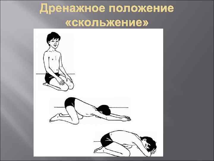 Дренажное положение «скольжение» 