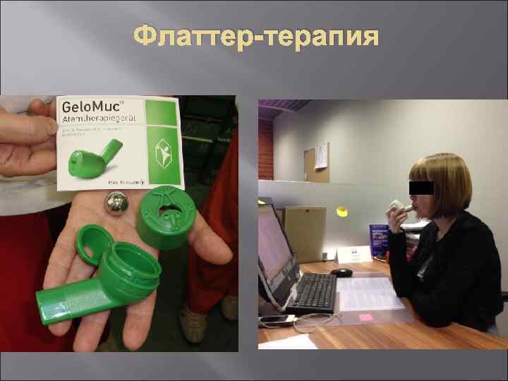 Флаттер-терапия 