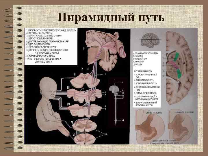 Простые и сложные расстройства движений схема