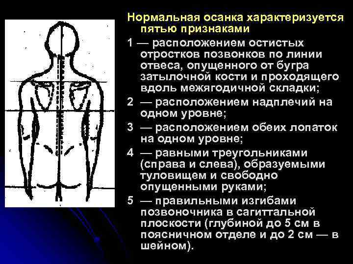 Нормальная осанка характеризуется пятью признаками 1 — расположением остистых отростков позвонков по линии отвеса,