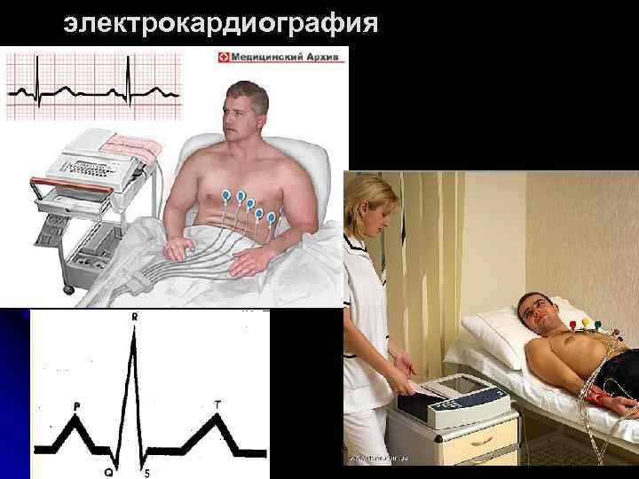 электрокардиография 