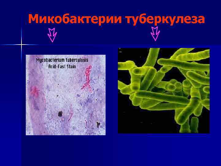 Микобактерии туберкулеза 