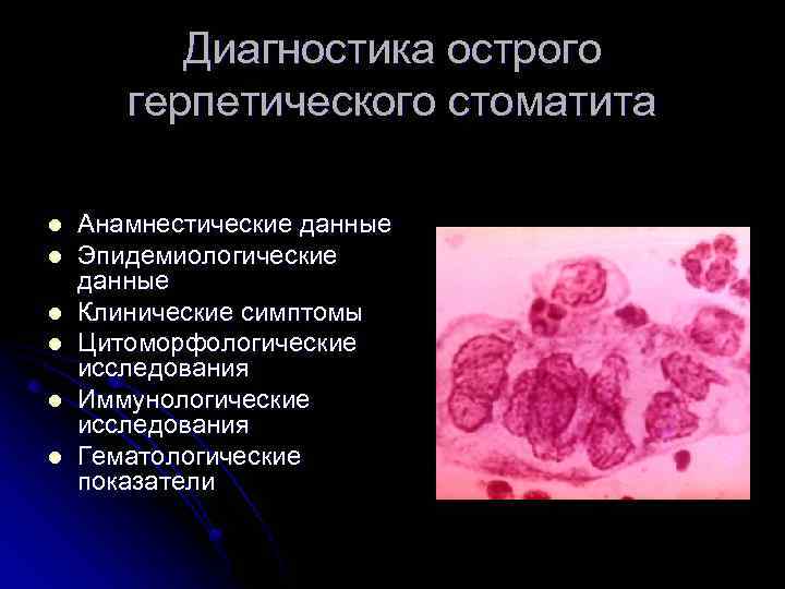 Диагностика острого герпетического стоматита l l l Анамнестические данные Эпидемиологические данные Клинические симптомы Цитоморфологические