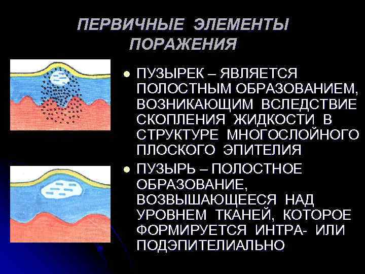 Первичные элементы. Первичные элементы поражения. Элементы поражения слизистой оболочки первичные и вторичные. Первичные и вторичные элементы поражения кожи. Первичные морфологические элементы поражения.