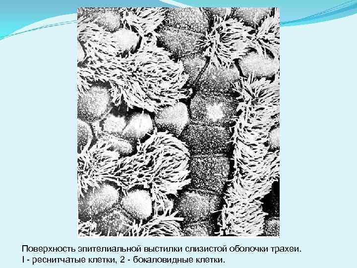 Поверхность эпителиальной выстилки слизистой оболочки трахеи. I - реснитчатые клетки, 2 - бокаловидные клетки.