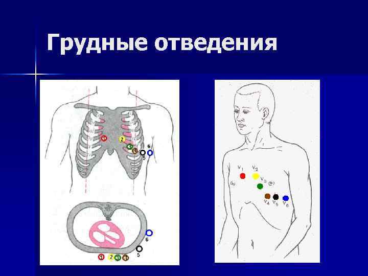 Грудные отведения 