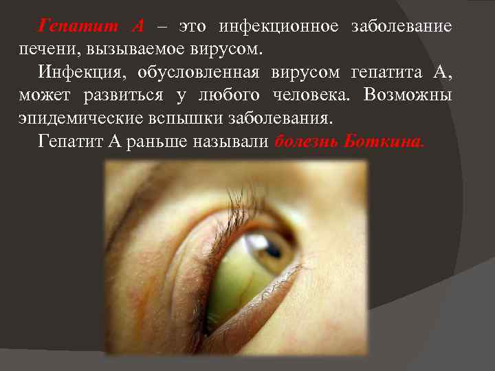 Гепатит А – это инфекционное заболевание печени, вызываемое вирусом. Инфекция, обусловленная вирусом гепатита А,