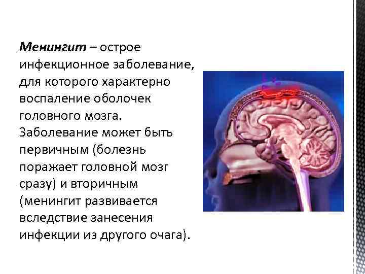Менингит – острое Менингит инфекционное заболевание, для которого характерно воспаление оболочек головного мозга. Заболевание