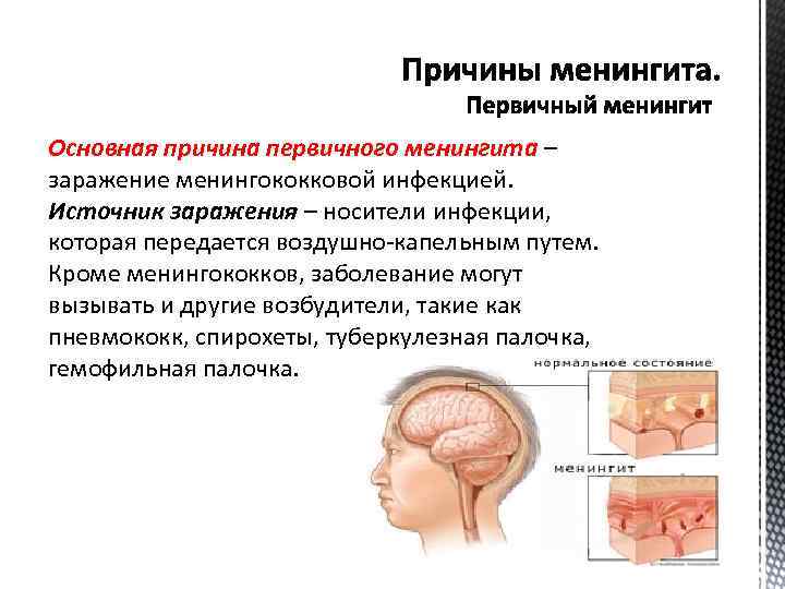 Основная причина первичного менингита – заражение менингококковой инфекцией. Источник заражения – носители инфекции, которая