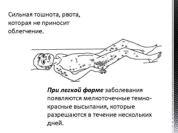 Сильная тошнота, рвота, которая не приносит облегчение. При легкой форме заболевания появляются мелкоточечные темнокрасные