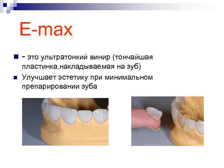 E-max n - это ультратонкий винир (тончайшая n пластинка, накладываемая на зуб) Улучшает эстетику