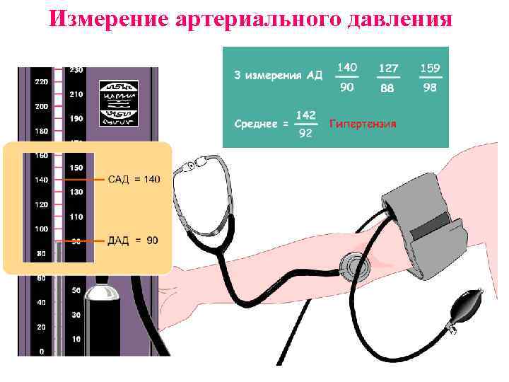 Измерение артериального давления 