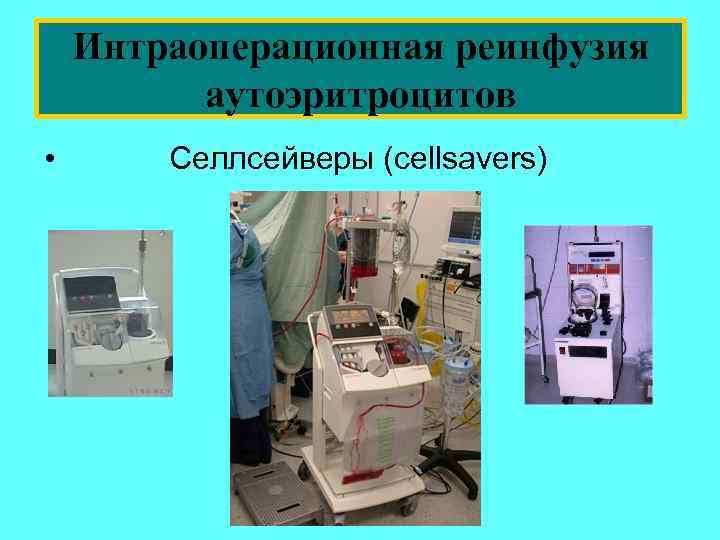 Интраоперационная реинфузия аутоэритроцитов • Селлсейверы (cellsavers) 