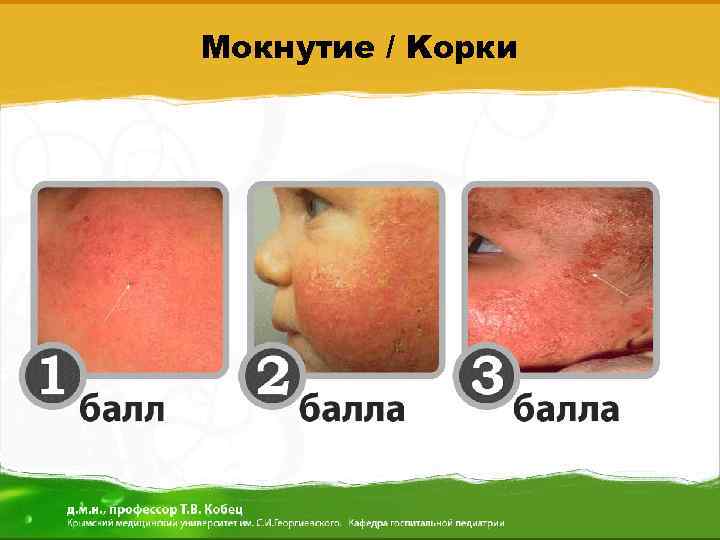 Мокнутие / Kорки 