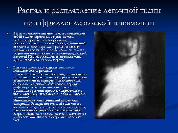 Распад и расплавление легочной ткани при фридлендеровской пневмонии n Эта разновидность пневмонии часто представляет
