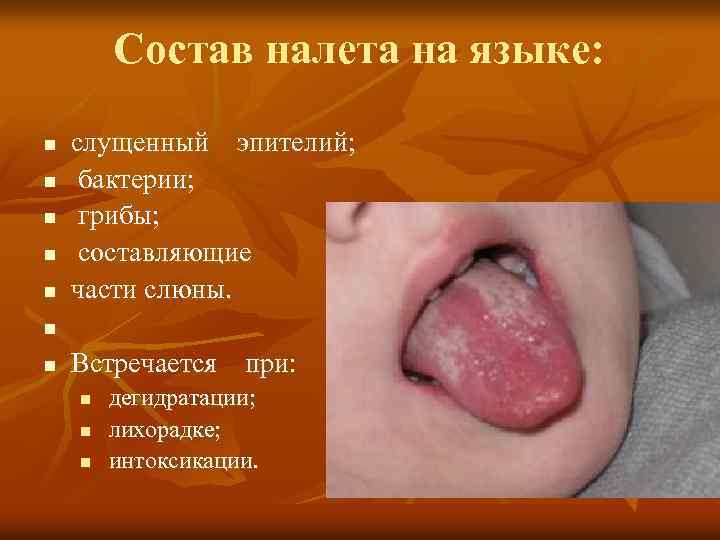 Состав налета на языке: n n n n слущенный эпителий; бактерии; грибы; составляющие части