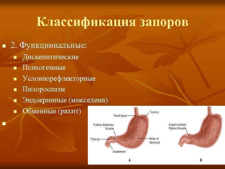Классификация запоров n 2. Функциональные: n n n n Дискенитические Психогенные Условнорефлекторные Пилороспазм Эндокринные